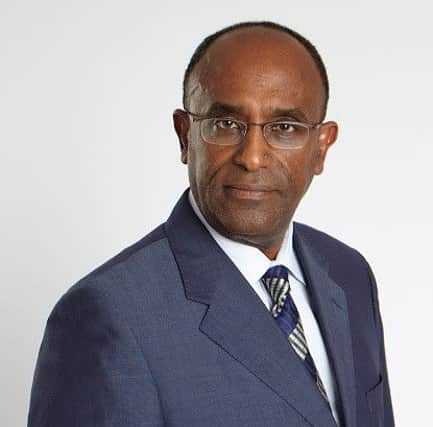 Professor Solomon Tesfaye is leading the study